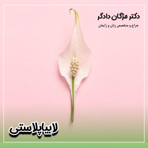 لابیاپلاستی - دکتر دادگر