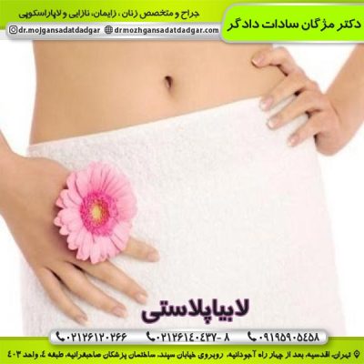 لابیاپلاستی
