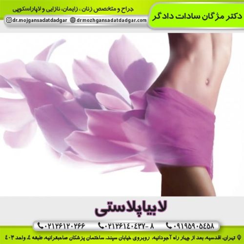 لابیاپلاستی