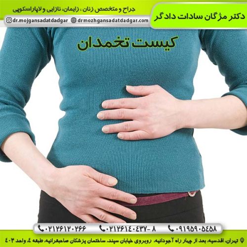 درمان کیست تخمدان - دکتر دادگر