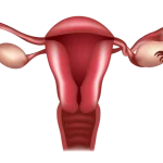 تخمدان چرخشی (Ovarian torsion)