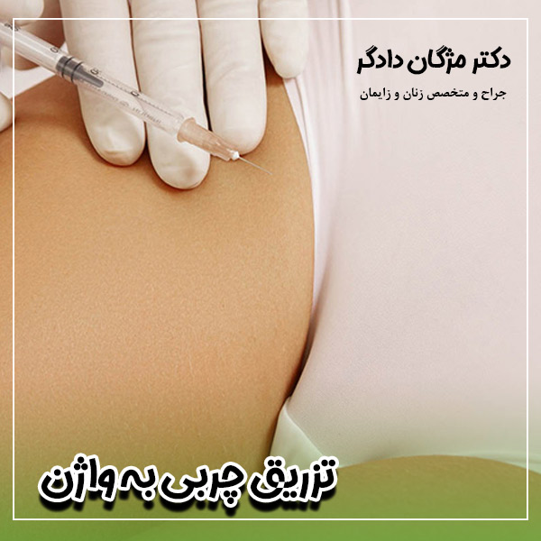 تزریق چربی به واژن در تهران - دکتر دادگر