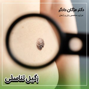 زگیل تناسلی - دکتر دادگر