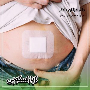 لاپاراسکوپی در تهران - دکتر دادگر