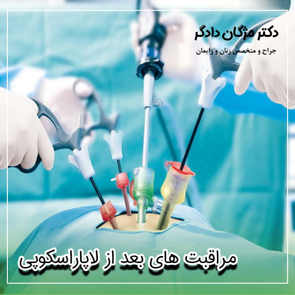 مراقبت های بعد از لاپاراسکوپی - دکتر دادگر